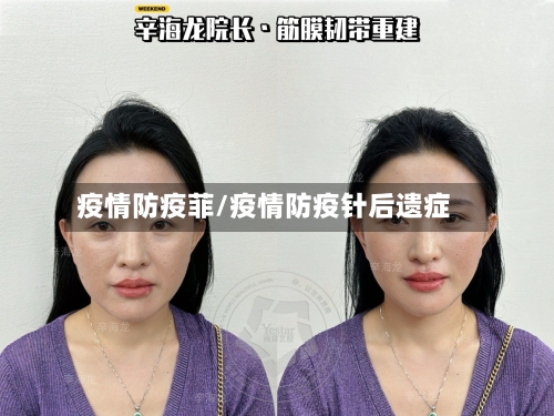 疫情防疫菲/疫情防疫针后遗症-第2张图片