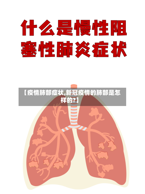 【疫情肺部症状,新冠疫情的肺部是怎样的?】-第2张图片